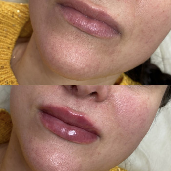 Анастасія Польгуй, Чернигов Фото - 55