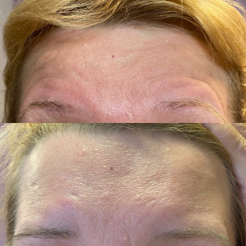 Анастасія Польгуй, Чернигов Фото - 41