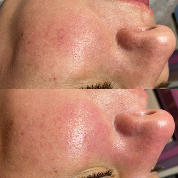 Анастасія Польгуй, Чернигов Фото - 42