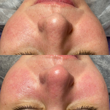 Анастасія Польгуй, Чернигов Фото - 43