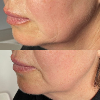 Анастасія Польгуй, Чернигов Фото - 45