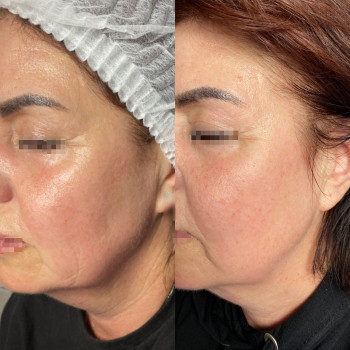 Анастасія Польгуй, Чернигов Фото - 48