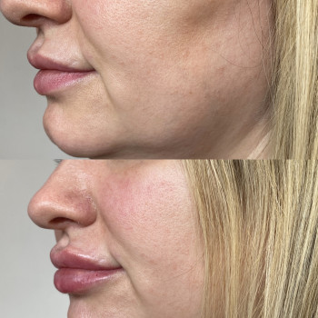 Анастасія Польгуй, Чернигов Фото - 19