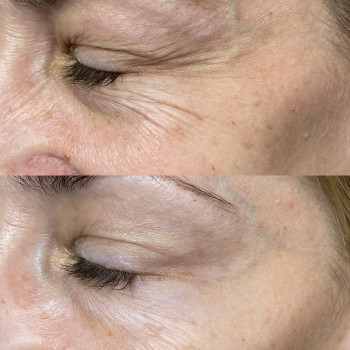 Анастасія Польгуй, Чернигов Фото - 23