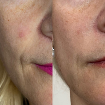 Анастасія Польгуй, Чернигов Фото - 25