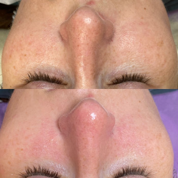 Анастасія Польгуй, Чернигов Фото - 31