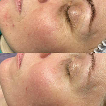 Анастасія Польгуй, Чернигов Фото - 35