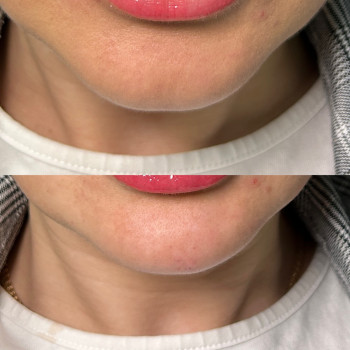 Анастасія Польгуй, Чернигов Фото - 36