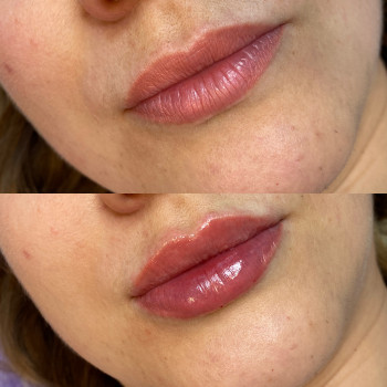 Анастасія Польгуй, Чернигов Фото - 5