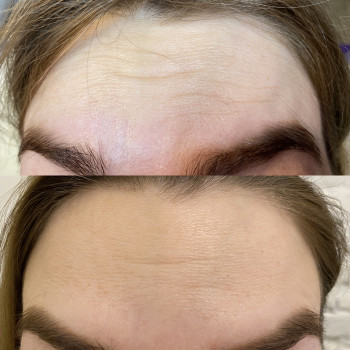 Анастасія Польгуй, Чернигов Фото - 7