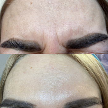 Анастасія Польгуй, Чернигов Фото - 8