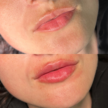 Анастасія Польгуй, Чернигов Фото - 14