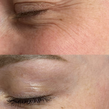 Анастасія Польгуй, Чернигов Фото - 17