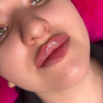 Олеся Сарапука, Запорожье Фото - 6