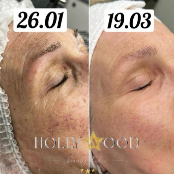 Олеся Сарапука, Запорожье Фото - 7