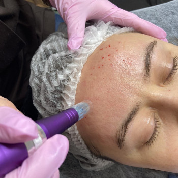 Ольга Войтенко, Бориспіль Фото - 8