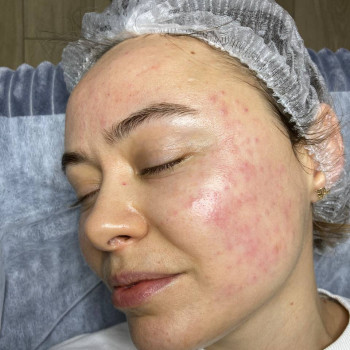 Ольга Войтенко, Бориспіль Фото - 10