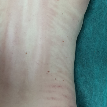 Масаж Гуа-ша
                    Массажист Виктория Киев