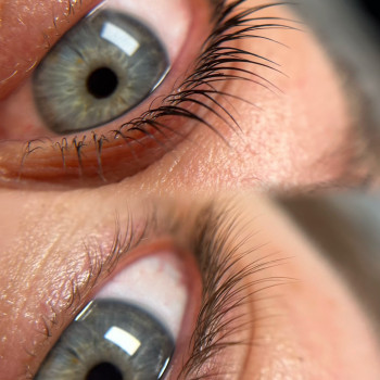 Анна Запорожец, Умань Фото - 19