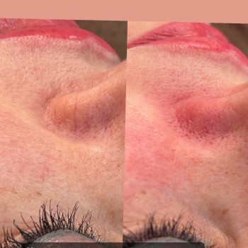 Ирина Колімбет, Полтава Фото - 22