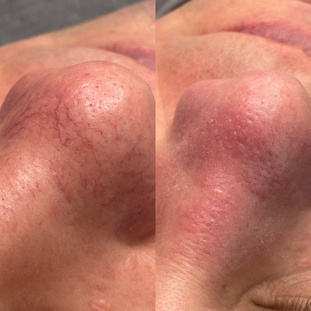 Ирина Колімбет, Полтава Фото - 21