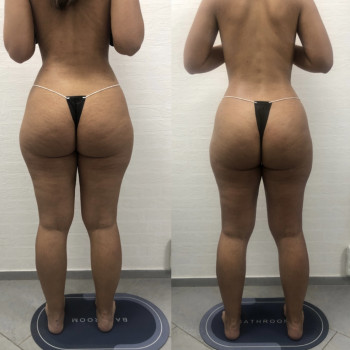 Курс 5+5 массаж и обетование.