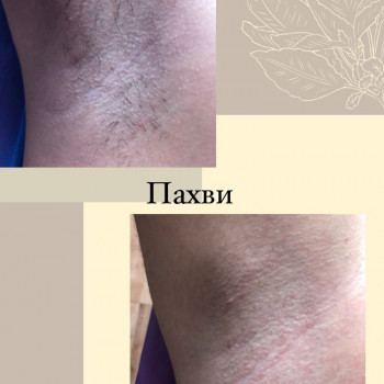 Емілія Філіппових, Вінниця Фото - 5