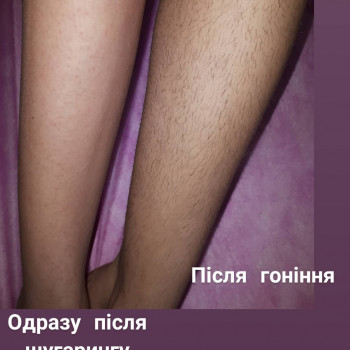 депиляция рук