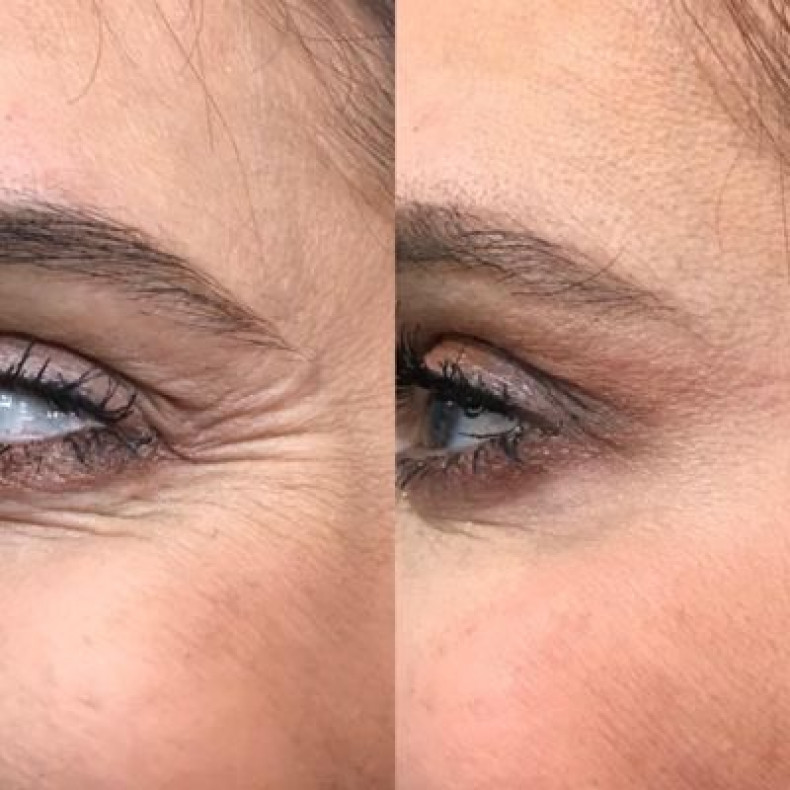  , фото - Косметолог-ін'єкціоніст Аніта Татарова