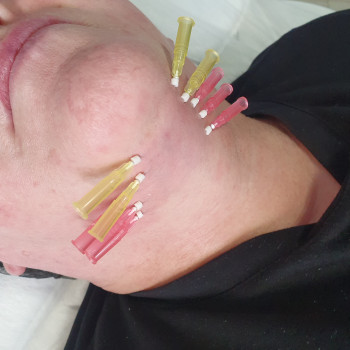 Техніка жабо       