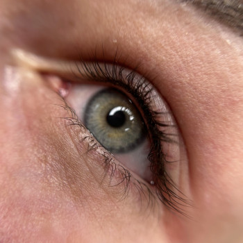 Перманент міжвійки.