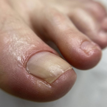 Педикюр
                    Мастер маникюра Наталья Кременчуг