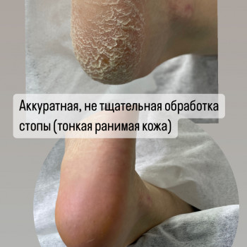 Педикюр
                    Мастер маникюра Наталья Кременчуг