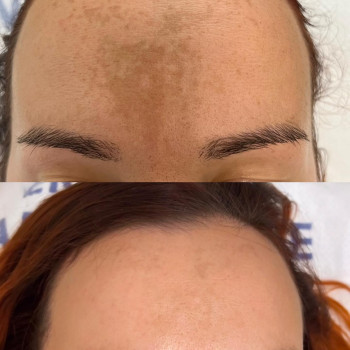 Laser Life, Винница Фото - 5