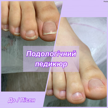 подолог