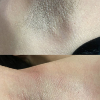 Пахви, 20 хв, 170 гон