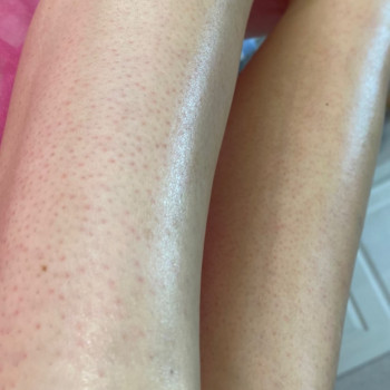 Тетяна Жук, Вінниця Фото - 5