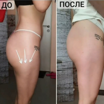 Ксенія Олександрова, Вінниця Фото - 5