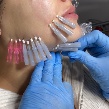 Gelios, Вінниця Фото - 5