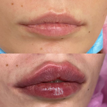 Наталья Петрова, Винница Фото - 6