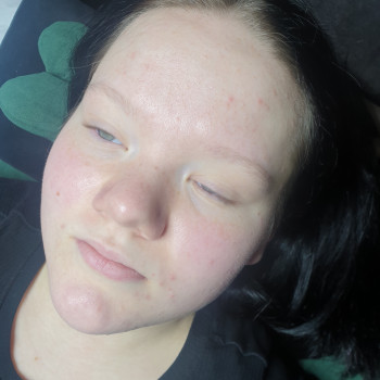 Корекція брів
                    Лешмейкер Оксана Киев