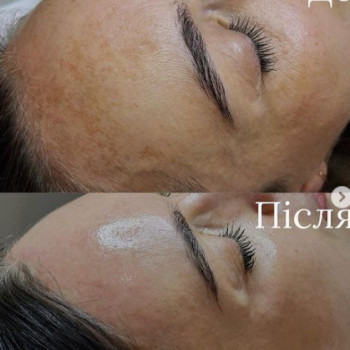 Goccia, Полтава Фото - 5