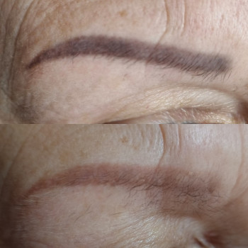 Видалення татуажу
                    Косметолог-эстетист Ольга Киев