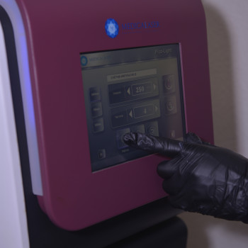 Видалення татуажу
                    Косметолог-эстетист Ольга Киев