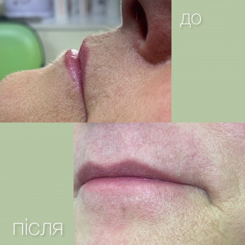 Фото из портфолио мастера Аліна Юнчик (мастер эпиляции, Хмельницкий)