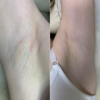 Фото з портфоліо майстра Аліна Юнчик (майстер епіляції, Хмельницький)