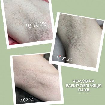 Фото з портфоліо майстра Аліна Юнчик (майстер епіляції, Хмельницький)