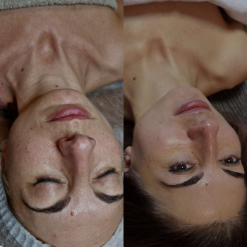 Догляд за обличчям
                    Косметолог-естетист Ольга Київ