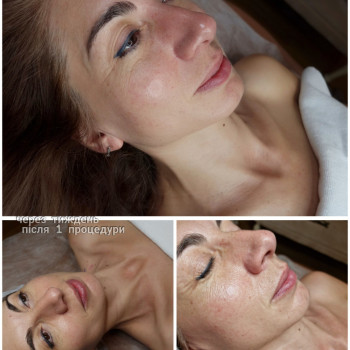 Догляд за обличчям
                    Косметолог-естетист Ольга Київ