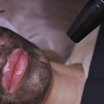 Догляд за обличчям
                    Косметолог-естетист Ольга Київ